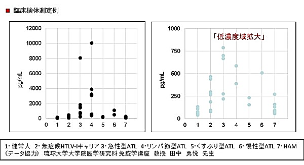 Tanaka Y, Takahashi Y, Tanaka R, Miyagi T, Saito M, Fukushima T. Association of high levels of plasma OX40 with acute adult T-cell leukemia. Int J Hematol. 2019 Jan 16.